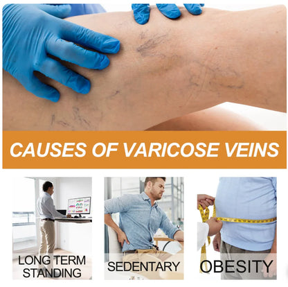 Varicose Vein Spray Leg Pain Gone, Confidence On 🔥 Buy 1 Get 1 FREE 🔥
