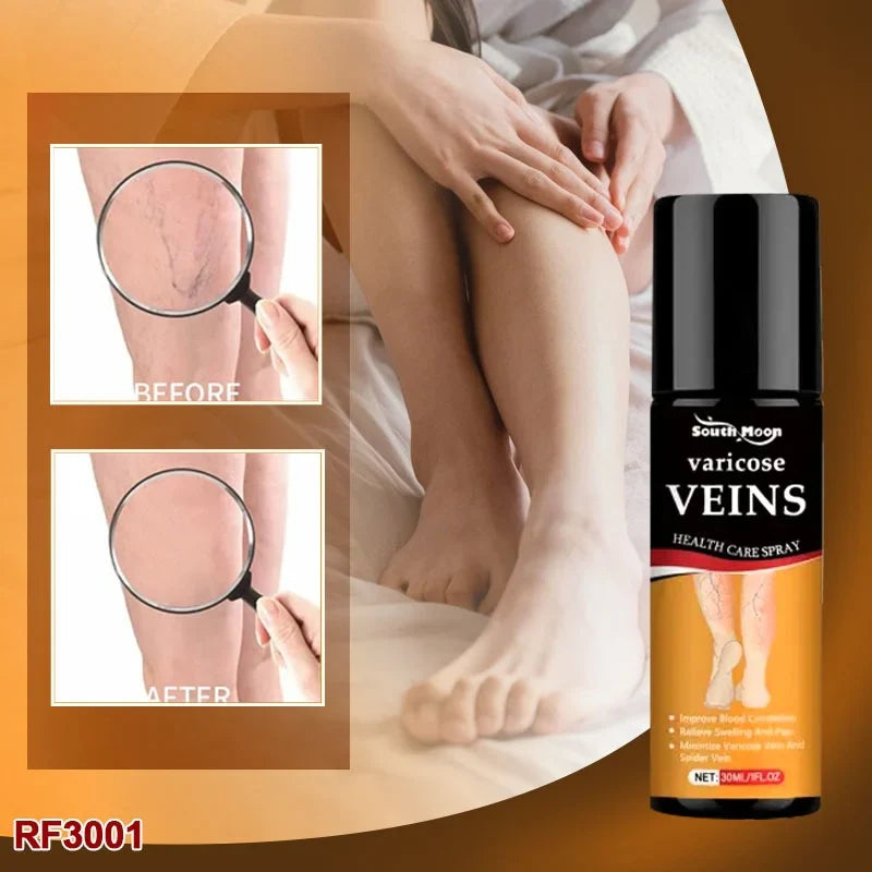 Varicose Vein Spray Leg Pain Gone, Confidence On 🔥 Buy 1 Get 1 FREE 🔥